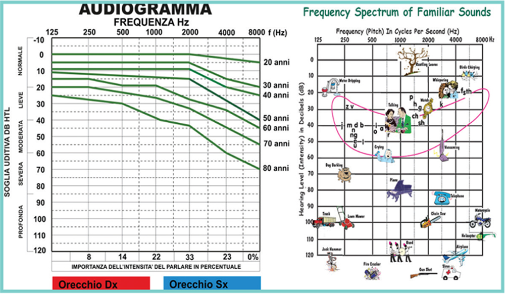 Audiometria tonale: a cosa serve?